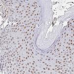 RCOR1 Antibody in Immunohistochemistry (Paraffin) (IHC (P))