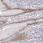 RCOR1 Antibody in Immunohistochemistry (Paraffin) (IHC (P))