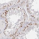 RCOR1 Antibody in Immunohistochemistry (Paraffin) (IHC (P))