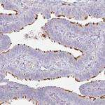 FHAD1 Polyclonal Antibody