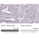 FHAD1 Antibody in Immunohistochemistry (IHC)
