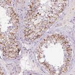 FNDC7 Antibody in Immunohistochemistry (Paraffin) (IHC (P))