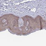 TUFT1 Antibody in Immunohistochemistry (Paraffin) (IHC (P))