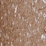 C1orf165 Polyclonal Antibody