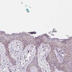 NDUFA1 Antibody in Immunohistochemistry (IHC)