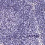 TAS2R38 Polyclonal Antibody