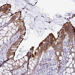 TAS2R38 Antibody in Immunohistochemistry (Paraffin) (IHC (P))