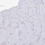 TAS2R38 Antibody in Immunohistochemistry (Paraffin) (IHC (P))