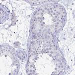 TAS2R38 Antibody in Immunohistochemistry (Paraffin) (IHC (P))