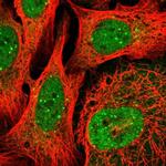 PQLC2L Polyclonal Antibody