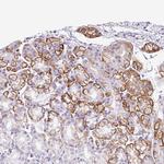 TARM1 Polyclonal Antibody