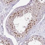 IMUP Antibody in Immunohistochemistry (Paraffin) (IHC (P))