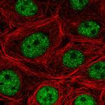 SF3B5 Polyclonal Antibody