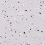 SF3B5 Antibody in Immunohistochemistry (Paraffin) (IHC (P))