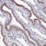 SF3B5 Antibody in Immunohistochemistry (Paraffin) (IHC (P))