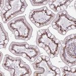 SF3B5 Antibody in Immunohistochemistry (Paraffin) (IHC (P))