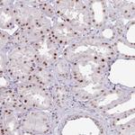 SF3B5 Antibody in Immunohistochemistry (Paraffin) (IHC (P))