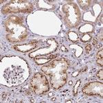 DIPA Polyclonal Antibody