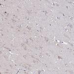 SKIV2L Antibody in Immunohistochemistry (Paraffin) (IHC (P))