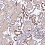SKIV2L Antibody in Immunohistochemistry (Paraffin) (IHC (P))