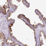 SKIV2L Polyclonal Antibody