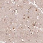 DHX35 Polyclonal Antibody