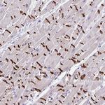 SLC16A6 Polyclonal Antibody