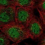 GOSR2 Polyclonal Antibody