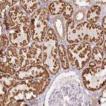 GOSR2 Antibody in Immunohistochemistry (Paraffin) (IHC (P))