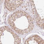 GOSR2 Antibody in Immunohistochemistry (Paraffin) (IHC (P))