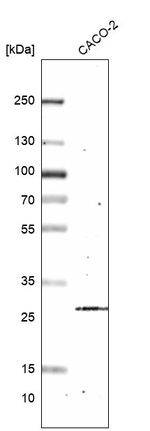 GOSR2 Antibody in Western Blot (WB)