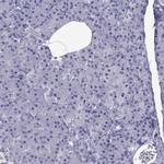Spectrin beta-4 Antibody in Immunohistochemistry (IHC)
