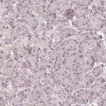 DEK Antibody in Immunohistochemistry (IHC)