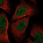 GSS Polyclonal Antibody