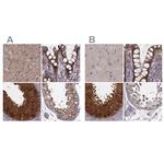GSS Antibody in Immunohistochemistry (IHC)