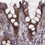 GSS Antibody in Immunohistochemistry (IHC)