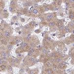 RPS15 Antibody in Immunohistochemistry (IHC)