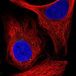 RAB30 Polyclonal Antibody