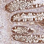 RAB30 Antibody in Immunohistochemistry (Paraffin) (IHC (P))