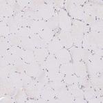 POFUT1 Antibody in Immunohistochemistry (Paraffin) (IHC (P))