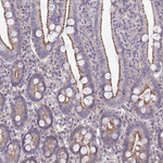 IST1 Antibody in Immunohistochemistry (Paraffin) (IHC (P))
