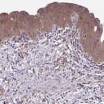 IST1 Antibody in Immunohistochemistry (IHC)