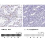 TEX19 Antibody