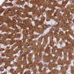 PTCHD2 Antibody in Immunohistochemistry (Paraffin) (IHC (P))