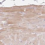 Bestrophin 3 Polyclonal Antibody