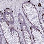 Krt222 Antibody in Immunohistochemistry (Paraffin) (IHC (P))