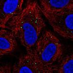 Krt222 Polyclonal Antibody