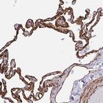 IGSF23 Polyclonal Antibody