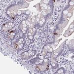 FBXL22 Polyclonal Antibody