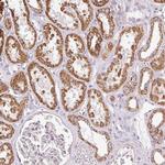 DAAM2 Antibody in Immunohistochemistry (Paraffin) (IHC (P))